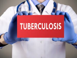 Tuberculosis Myths and Facts