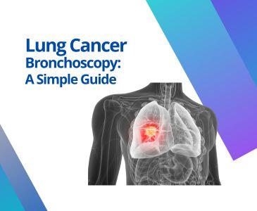 lung-cancer-bronchoscopy