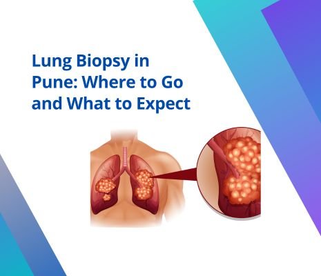 Lung Biopsy in Pune